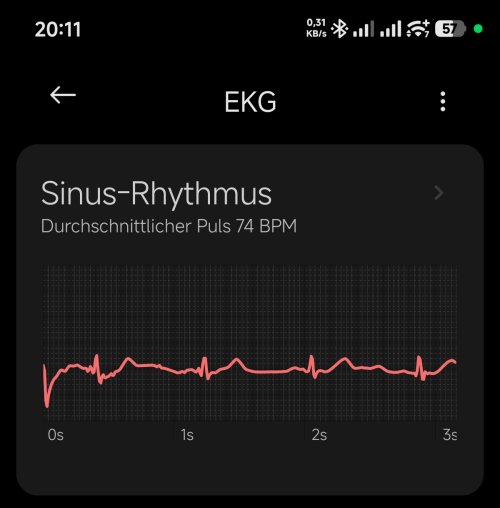 Screenshot_2026-07-28-20-11-21-397_com.xiaomi.wearable-edit.jpg