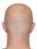 bald-head-from-back-gone-today-hair-tomorrow-new-3.jpg